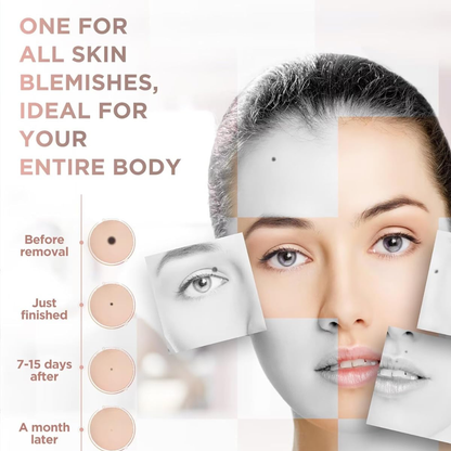 Nuvexa™ Skin Tag Remover Pen